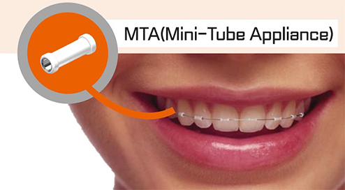 MTA Mini-Tube Appliance